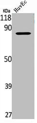 Western Blot analysis of HuvEc cells using TLK1 Polyclonal Antibody