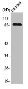 Western Blot analysis of COLO205 cells using TLK2 Polyclonal Antibody