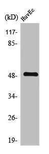 Western Blot analysis of HuvEc cells using TMPRSS3 Polyclonal Antibody