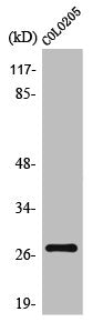 Western Blot analysis of HepG2 cells using TP53INP1 Polyclonal Antibody
