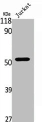 Western Blot analysis of Jurkat cells using TRAF2 Polyclonal Antibody
