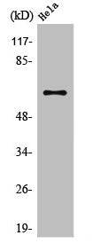 Western Blot analysis of COLO205 cells using TRAF3 Polyclonal Antibody