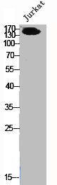 Western Blot analysis of Jurkat cells using TRAP220 Polyclonal Antibody