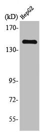 Western Blot analysis of HepG2 cells using Trk B Polyclonal Antibody