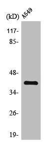 Western Blot analysis of A549 cells using TROP-2 Polyclonal Antibody