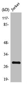 Western Blot analysis of Jurkat cells using Troponin I-C Polyclonal Antibody