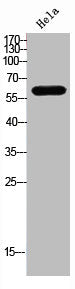 Western Blot analysis of Hela cells using TRP2 Polyclonal Antibody