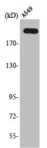 Western Blot analysis of A549 cells using T-type Ca++ CP α1H Polyclonal Antibody