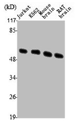 Western Blot analysis of Jurkat K562 MOUSE-BRAIN RAT-BRAIN cells using Tubulin β Polyclonal Antibody