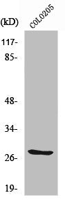 Western Blot analysis of 293 cells using TWEAK Polyclonal Antibody