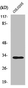 Western Blot analysis of COLO205 cells using UBCE7IP4 Polyclonal Antibody