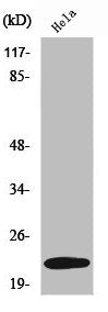 Western Blot analysis of K562 cells using UBE2T Polyclonal Antibody