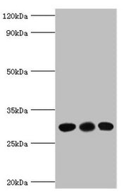 Western blot All lanes: CA1 antibody at 6µg/ml Lane 1: Jurkat whole cell lysate Lane 2: K562 whole cell lysate Lane 3: Mouse spleen tissue Secondary Goat polyclonal to rabbit IgG at 1/10000 dilution Predicted band size: 29 kDa Observed band size:...