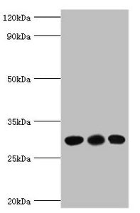 Western blot All lanes: CA1 antibody at 6µg/ml Lane 1: Jurkat whole cell lysate Lane 2: K562 whole cell lysate Lane 3: Mouse spleen tissue Secondary Goat polyclonal to rabbit IgG at 1/10000 dilution Predicted band size: 29 kDa Observed band size:...