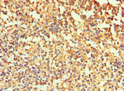 Immunohistochemistry of paraffin-embedded human spleen tissue using CSB-PA004364ESR2HU at dilution of 1:100