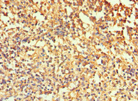 Immunohistochemistry of paraffin-embedded human spleen tissue using CSB-PA004364ESR2HU at dilution of 1:100