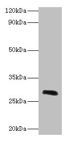 Western blot All lanes: Ca1 antibody at 2µg/ml + Rat spleen tissue Secondary Goat polyclonal to rabbit IgG at 1/10000 dilution Predicted band size: 29 kDa Observed band size: 29 kDa