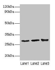 Western blot All lanes: Ca1 antibody at 2µg/ml Lane 1: Rat spleen tissue Lane 2: Rat lung tissue Lane 3: Rat kidney tissue Secondary Goat polyclonal to rabbit IgG at 1/10000 dilution Predicted band size: 29 kDa Observed band size: 29 kDa