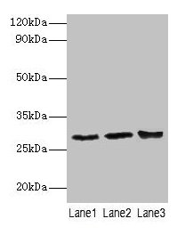 Western blot All lanes: Ca1 antibody at 2µg/ml Lane 1: Rat spleen tissue Lane 2: Rat lung tissue Lane 3: Rat kidney tissue Secondary Goat polyclonal to rabbit IgG at 1/10000 dilution Predicted band size: 29 kDa Observed band size: 29 kDa