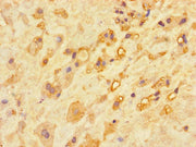 Immunohistochemistry of paraffin-embedded human placenta tissue using CSB-PA004366LA01HU at dilution of 1:100