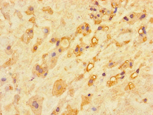 Immunohistochemistry of paraffin-embedded human placenta tissue using CSB-PA004366LA01HU at dilution of 1:100