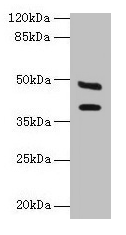 Western blot All lanes: CA12 antibody at 6µg/ml + Mouse kidney tissue Secondary Goat polyclonal to rabbit IgG at 1/10000 dilution Predicted band size: 40, 39 kDa Observed band size: 40, 48 kDa