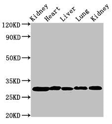 Western Blot Positive WB detected in: Rat kidney tissue, Rat heart tissue, Rat liver tissue, Mouse lung tissue, Mouse kidney tissue All lanes: CA2 antibody at 2µg/ml Secondary Goat polyclonal to rabbit IgG at 1/50000 dilution Predicted band size:...