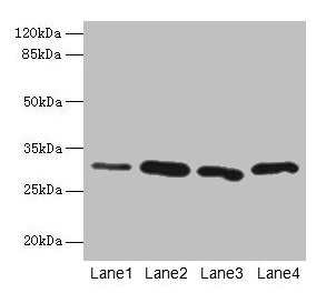 Western blot All lanes: CA3 antibody at 2µg/ml Lane 1: Hela whole cell lysate Lane 2: HepG2 whole cell lysate Lane 3: K562 whole cell lysate Lane 4: NIH/3T3 whole cell lysate Secondary Goat polyclonal to rabbit IgG at 1/10000 dilution Predicted ba...