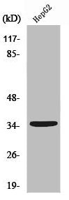 Western Blot analysis of Jurkat cells using Ubr1 Polyclonal Antibody