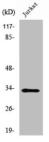 Western Blot analysis of Jurkat cells using UCP3 Polyclonal Antibody