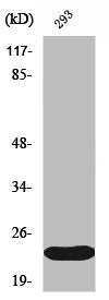 Western Blot analysis of 293 cells using ULK3 Polyclonal Antibody