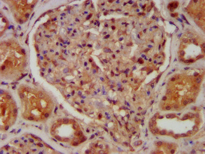 IHC image of CSB-PA004390LA01HU diluted at 1:400 and staining in paraffin-embedded human kidney tissue performed on a Leica BondTM system. After dewaxing and hydration, antigen retrieval was mediated by high pressure in a citrate buffer (pH 6.0)....