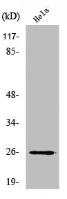 Western Blot analysis of HeLa cells using UMP-CMP Kinase Polyclonal Antibody