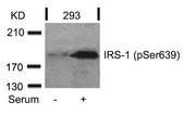 Western blot analysis of extracts from 293 cells untreated or treated with serum using IRS-1(Phospho-Ser639) Antibody.