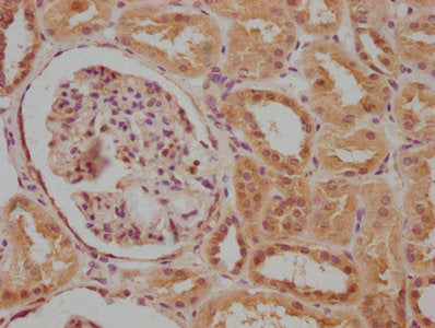IHC image of CSB-PA004398LA01HU diluted at 1:100 and staining in paraffin-embedded human kidney tissue performed on a Leica BondTM system. After dewaxing and hydration, antigen retrieval was mediated by high pressure in a citrate buffer (pH 6.0)....