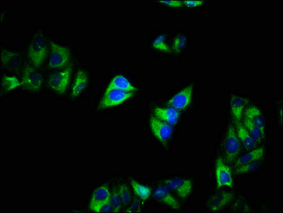 Immunofluorescence staining of Hela cells with CSB-PA004407LA01HU at 1:200, counter-stained with DAPI. The cells were fixed in 4% formaldehyde, permeabilized using 0.2% Triton X-100 and blocked in 10% normal Goat Serum. The cells were then incubat...