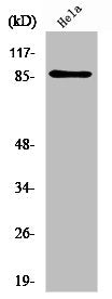 Western Blot analysis of HeLa cells using UTP14A Polyclonal Antibody