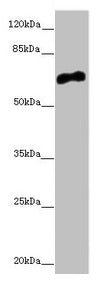 Western blot All lanes: CACNB1 antibody at 6.68µg/ml + HepG2 whole cell lysate Secondary Goat polyclonal to rabbit IgG at 1/10000 dilution Predicted band size: 66, 58, 54 kDa Observed band size: 66 kDa