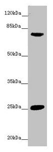 Western blot All lanes: CACNB1 antibody at 8.2 ug/ml + Mouse liver tissue Secondary Goat polyclonal to rabbit IgG at 1/10000 dilution Predicted band size: 66, 58, 54 kDa Observed band size: 66 kDa