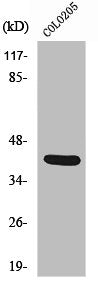 Western Blot analysis of COLO205 cells using Vasohibin Polyclonal Antibody