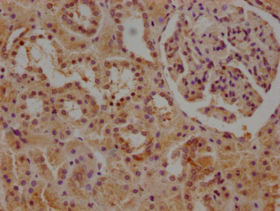 IHC image of CSB-PA004432LA01HU diluted at 1:1000 and staining in paraffin-embedded human kidney tissue performed on a Leica BondTM system. After dewaxing and hydration, antigen retrieval was mediated by high pressure in a citrate buffer (pH 6.0)....