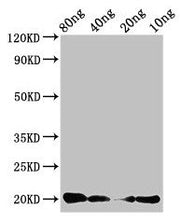 Western Blot Positive WB detected in Recombinant protein All lanes: CALCA antibody at 3µg/ml Secondary Goat polyclonal to rabbit IgG at 1/50000 dilution Predicted band size: 20 kDa Observed band size: 20 kDa