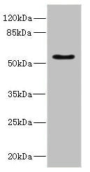 Western blot All lanes: CALCRantibody IgG at 5.24ug/ml + Rat heart tissue Secondary Goat polyclonal to rabbit IgG at 1/10000 dilution Predicted band size: 60, 56, 50, 52, 35, 33 kDa Observed band size: 60 kDa