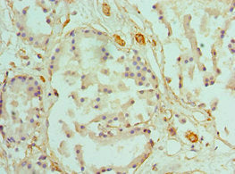Immunohistochemistry of paraffin-embedded human prostate tissue using CSB-PA004441DSR1HU at dilution of 1:100