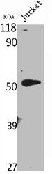 Western Blot analysis of Jurkat cells using VDR Polyclonal Antibody