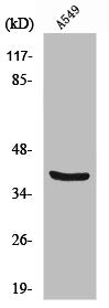 Western Blot analysis of A549 cells using Vimentin Polyclonal Antibody