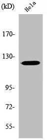 Western Blot analysis of HeLa cells using Vinculin Polyclonal Antibody