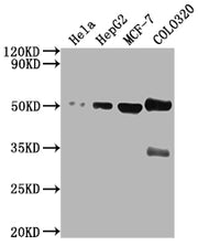 Western Blot Positive WB detected in: Hela whole cell lysate, HepG2 whole cell lysate, MCF-7 whole cell lysate, COLO320 whole cell lysate All lanes: CALR antibody at 1:2000 Secondary Goat polyclonal to rabbit IgG at 1/50000 dilution Predicted band...