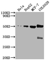 Western Blot Positive WB detected in: Hela whole cell lysate, HepG2 whole cell lysate, MCF-7 whole cell lysate, COLO320 whole cell lysate All lanes: CALR antibody at 1:2000 Secondary Goat polyclonal to rabbit IgG at 1/50000 dilution Predicted band...