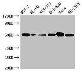 Western Blot Positive WB detected in: MCF-7 whole cell lysate, HL60 whole cell lysate, NIH/3T3 whole cell lysate, Colo320 whole cell lysate, Hela whole cell lysate, SH-SY5Y whole cell lysate All lanes: CALR antibody at 2ug/ml Secondary Goat polycl...